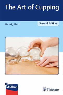 The Art of Cupping (eBook, PDF) - Manz, Hedwig