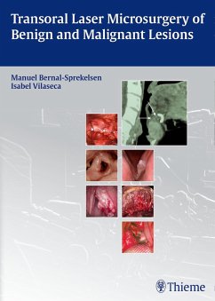Transoral Laser Microsurgery of Benign and Malignant Lesions (eBook, PDF)