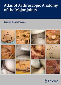 Atlas of Arthroscopic Anatomy of the Major Joints (eBook, PDF) - Blanco Moreno, Cristian