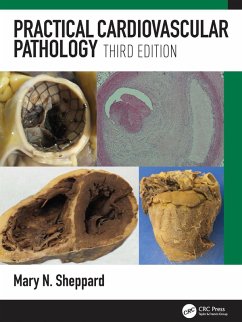 Practical Cardiovascular Pathology (eBook, ePUB) - Sheppard, Mary N.