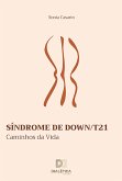 Síndrome de Down/T21 (eBook, ePUB)