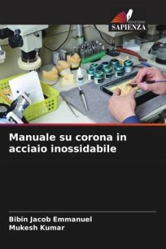 Manuale su corona in acciaio inossidabile - Emmanuel, Bibin Jacob;Kumar, Mukesh