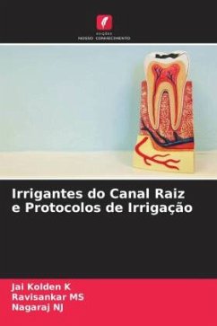 Irrigantes do Canal Raiz e Protocolos de Irrigação - K, Jai Kolden;MS, Ravisankar;NJ, Nagaraj