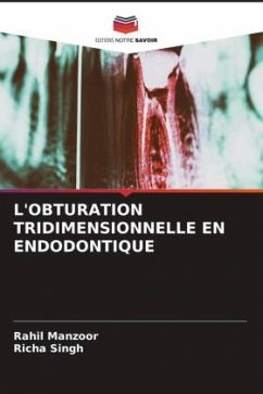 L'OBTURATION TRIDIMENSIONNELLE EN ENDODONTIQUE - Manzoor, Rahil;Singh, Richa