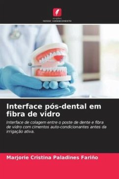 Interface pós-dental em fibra de vidro - Paladines Fariño, Marjorie Cristina