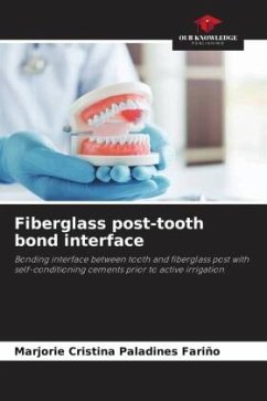 Fiberglass post-tooth bond interface - Paladines Fariño, Marjorie Cristina