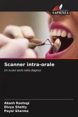 Scanner intra-orale