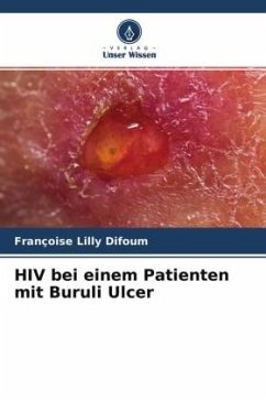 HIV bei einem Patienten mit Buruli Ulcer - Difoum, Françoise Lilly
