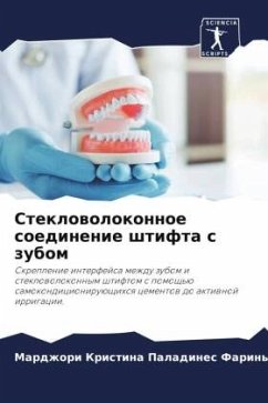 Cover Steklowolokonnoe soedinenie shtifta s zubom