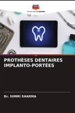 PROTHÈSES DENTAIRES IMPLANTO-PORTÉES