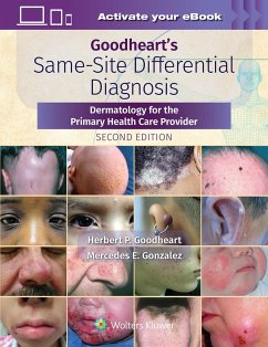 Goodheart's Same-Site Differential Diagnosis - Goodheart, Herbert