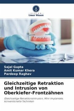 Gleichzeitige Retraktion und Intrusion von Oberkiefer-Frontzähnen - Gupta, Sajal;Khera, Amit Kumar;Raghav, Pardeep