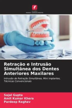 Retração e Intrusão Simultânea dos Dentes Anteriores Maxilares - Gupta, Sajal;Khera, Amit Kumar;Raghav, Pardeep