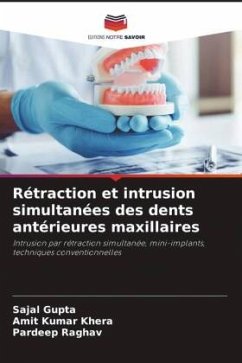 Rétraction et intrusion simultanées des dents antérieures maxillaires - Gupta, Sajal;Khera, Amit Kumar;Raghav, Pardeep