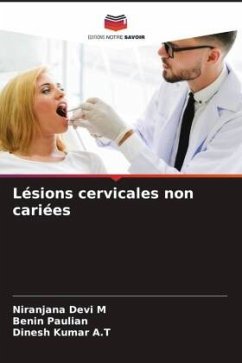 Lésions cervicales non cariées - Devi M, Niranjana;Paulian, Benin;Kumar A.T, Dinesh