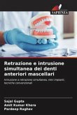 Retrazione e intrusione simultanea dei denti anteriori mascellari