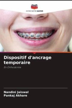 Dispositif d'ancrage temporaire - Jaiswal, Nandini;Akhare, Pankaj