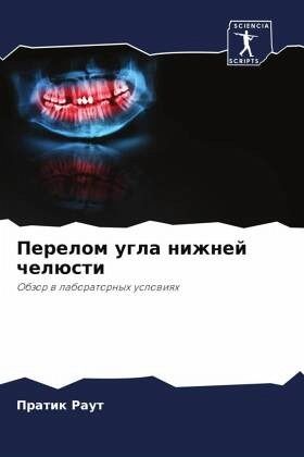 Perelom ugla nizhnej chelüsti Perelom ugla nizhnej chelüsti