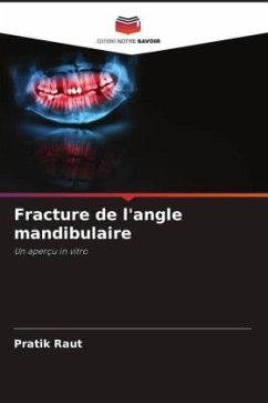 Fracture de l'angle mandibulaire - Raut, Pratik