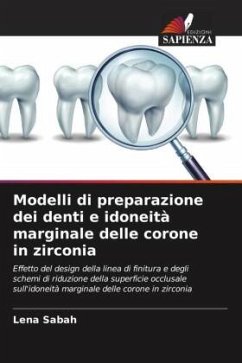 Modelli di preparazione dei denti e idoneità marginale delle corone in zirconia - Sabah, Lena