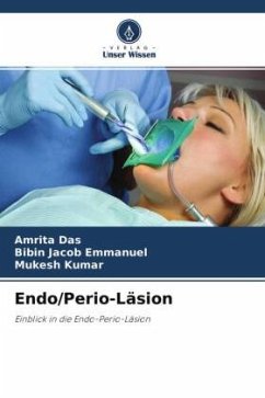Endo/Perio-Läsion - Das, Amrita;Emmanuel, Bibin Jacob;Kumar, Mukesh