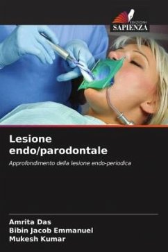 Lesione endo/parodontale - Das, Amrita;Emmanuel, Bibin Jacob;Kumar, Mukesh