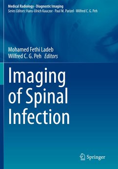 Imaging of Spinal Infection