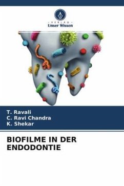 BIOFILME IN DER ENDODONTIE - Ravali, T.;Ravi Chandra, C.;Shekar, K.