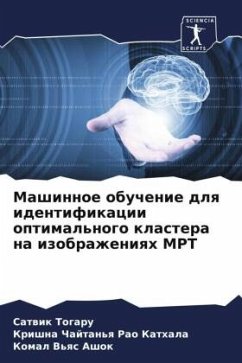 Mashinnoe obuchenie dlq identifikacii optimal'nogo klastera na izobrazheniqh MRT - Togaru, Satwik;Kathala, Krishna Chajtan'q Rao;Ashok, Komal V'qs