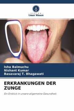 ERKRANKUNGEN DER ZUNGE - Balmuchu, Isha;Kumar, Nishant;Bhagawati, Basavaraj T.