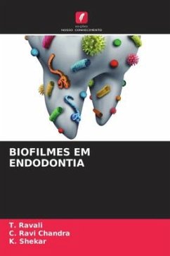 BIOFILMES EM ENDODONTIA - Ravali, T.;Ravi Chandra, C.;Shekar, K.