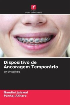 Dispositivo de Ancoragem Temporário - Jaiswal, Nandini;Akhare, Pankaj