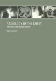 Radiology of the Chest and Related Conditions (eBook, ePUB)