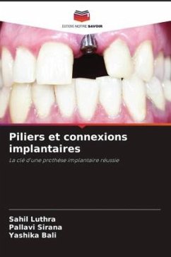 Piliers et connexions implantaires - Luthra, Sahil;Sirana, Pallavi;Bali, Yashika