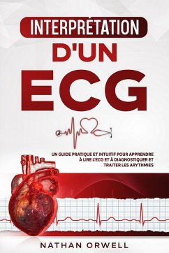 Interprétation d'un ECG: Un Guide Pratique et Intuitif pour Apprendre à Lire un ECG et pour Diagnostiquer et Traiter les Arythmies (eBook, ePUB) - Orwell, Nathan