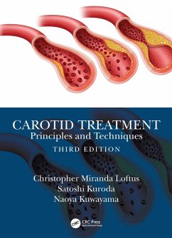 Carotid Treatment: Principles and Techniques - Loftus, Christopher Miranda (Center for Devices and Radiological Hea; Kuroda, Satoshi (University of Toyama, Japan); Kuwayama, Naoya (University of Toyama, Japan)