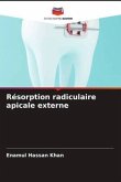 Résorption radiculaire apicale externe