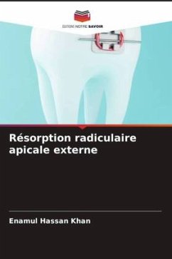Résorption radiculaire apicale externe - Khan, Enamul Hassan;Agarwal, Ankur;Kumar, Reena R.