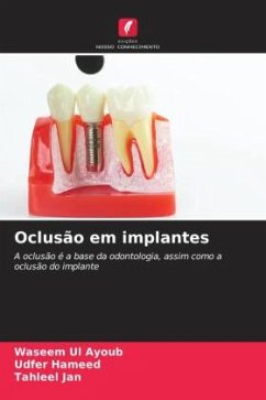 Oclusão em implantes - Ul Ayoub, Waseem;Hameed, Udfer;Jan, Tahleel