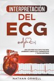 Interpretación del ECG