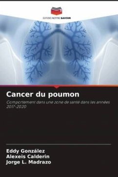 Cancer du poumon - González, Eddy;Calderin, Alexeis;Madrazo, Jorge L.