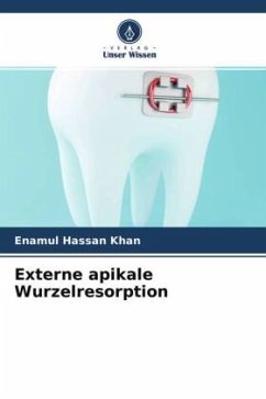 Externe apikale Wurzelresorption - Khan, Enamul Hassan;Agarwal, Ankur;Kumar, Reena R.