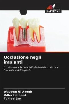 Occlusione negli impianti - Ul Ayoub, Waseem;Hameed, Udfer;Jan, Tahleel