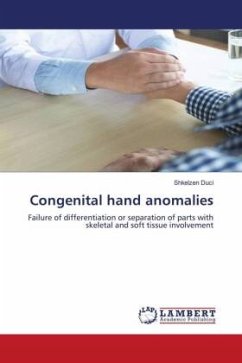 Congenital hand anomalies
