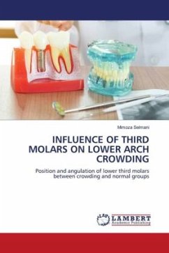 INFLUENCE OF THIRD MOLARS ON LOWER ARCH CROWDING - Selmani, Mimoza