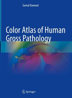 Color Atlas of Human Gross Pathology (eBook, PDF) - Dawood, Gamal