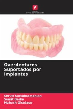Overdentures Suportados por Implantes - Saisubramanian, Shruti;Bedia, Sumit;Ghadage, Mahesh