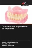 Overdenture supportate da impianti