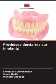 Prothèses dentaires sur implants