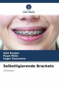 Selbstligierende Brackets - Ranjan, Alok;mate, payal;Sonowane, Sagar